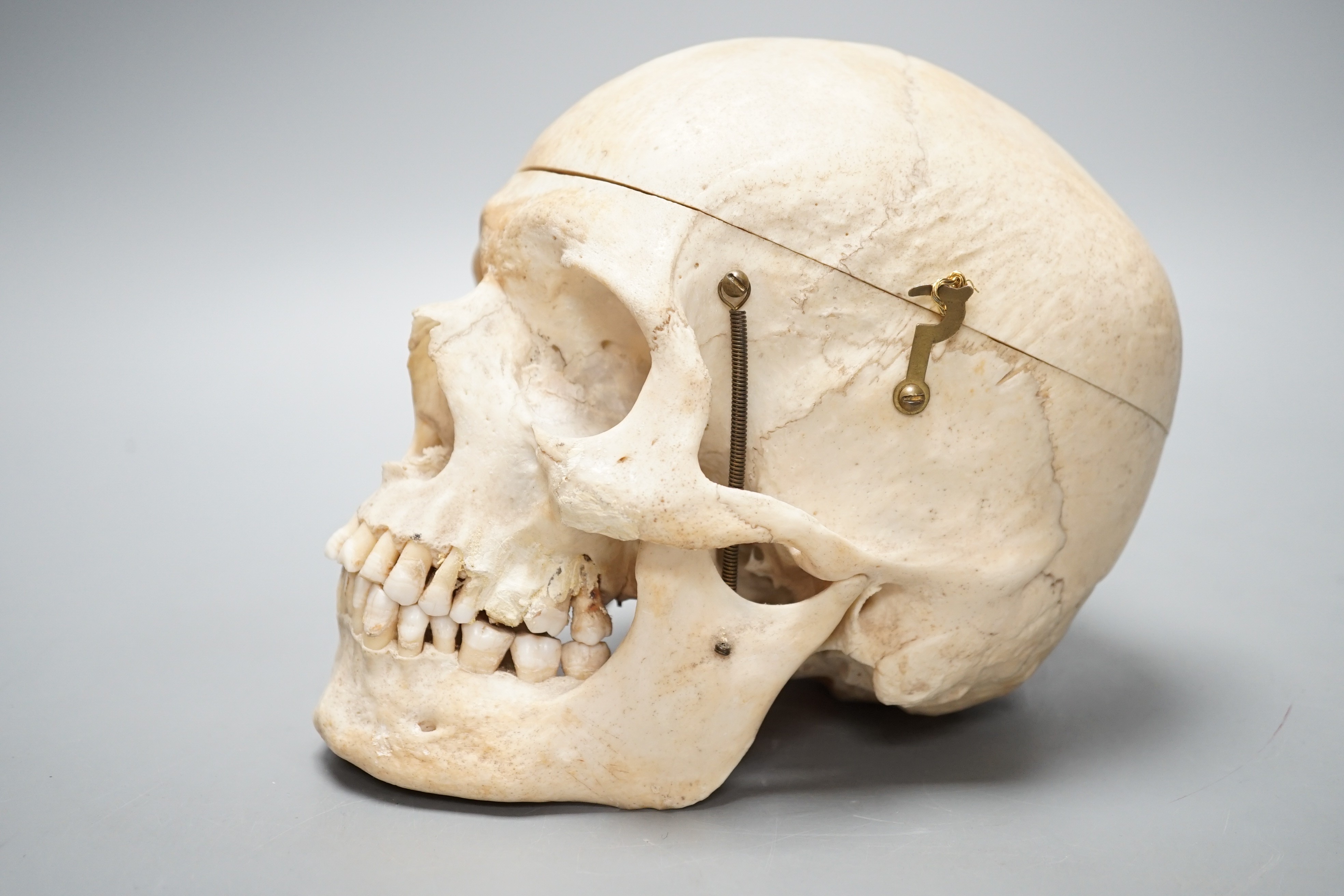 A human skull with removable cranium and spring loaded jaw 15.5cm